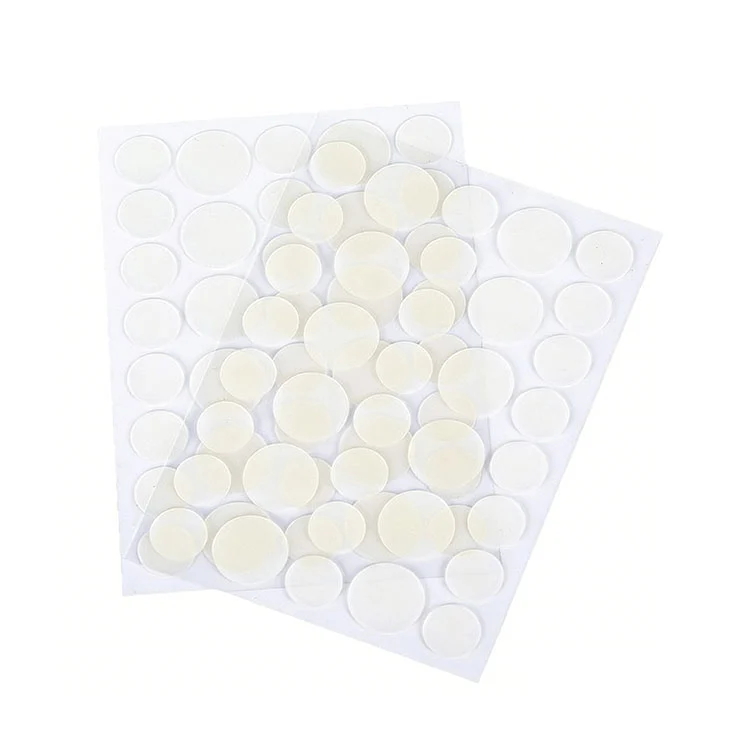 முகத்தில் உள்ள கரும்புள்ளிகளை நீக்கும் சிகிச்சை